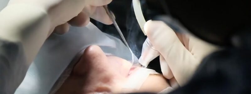 В Ужгороді будують клініку пластичної хірургії